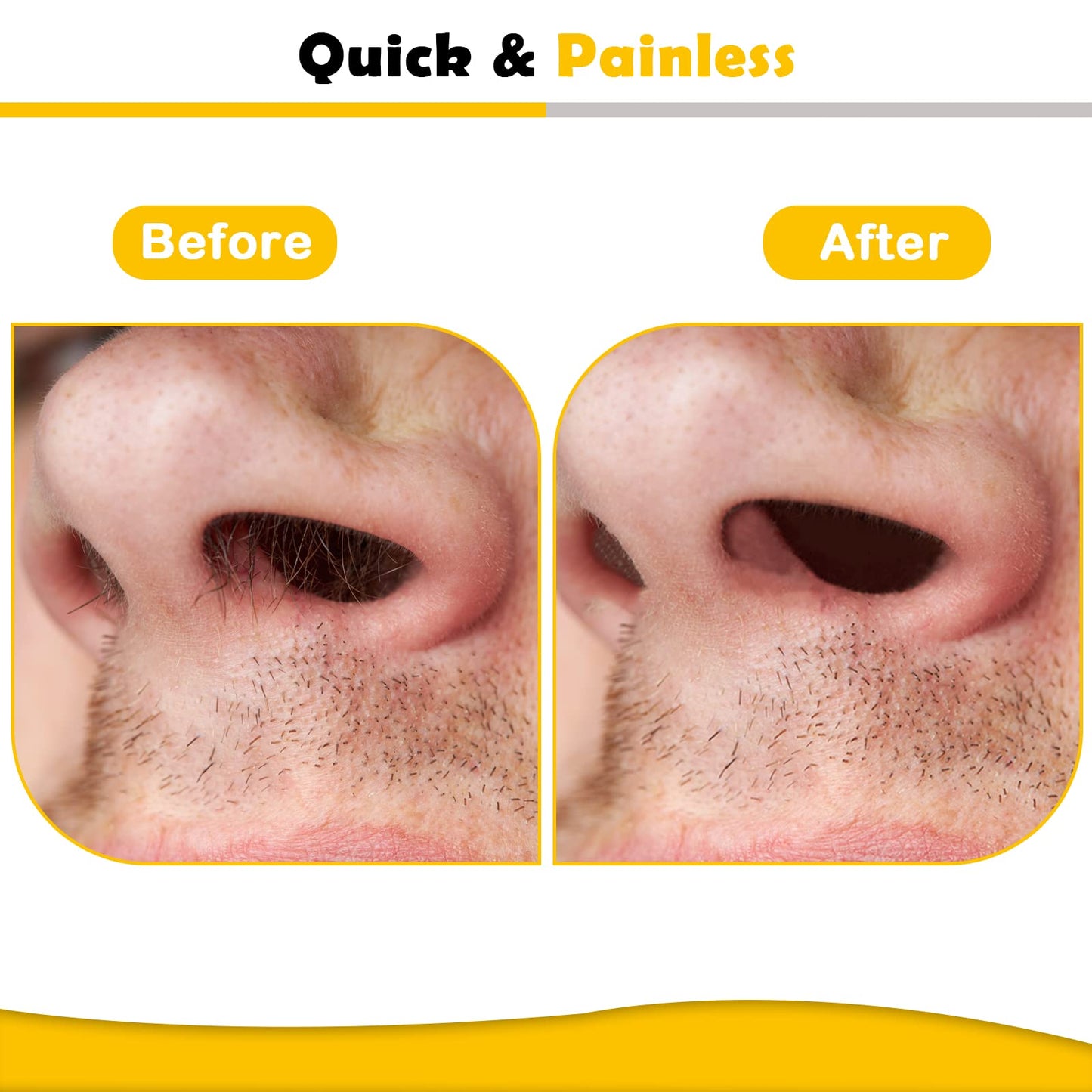 Depilador Nasal Púlex® Depilación sin dolor