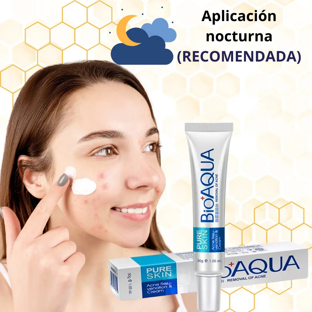 Crema AntiAcne - bioaqua 50% de descuento