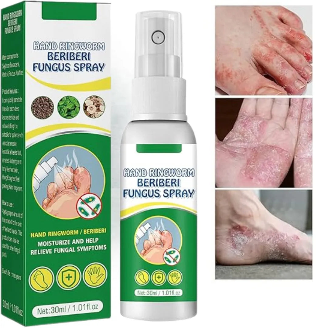 Spray Antihongos - Beriberi Fungus Paga 1 lleva 2 + envio gratis