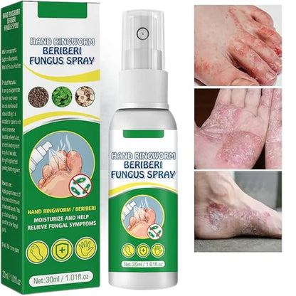 Spray Antihongos - Beriberi Fungus Paga 1 lleva 2 + envio gratis