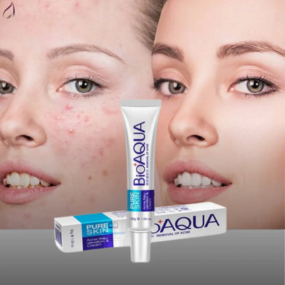 Crema AntiAcne - bioaqua 50% de descuento