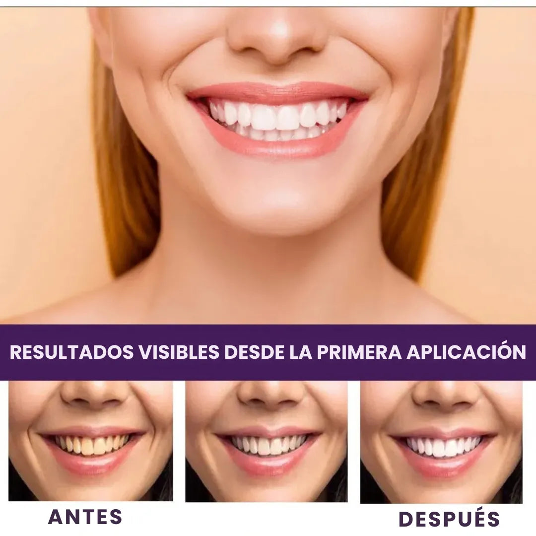 Blanqueador Dental Morado - Efecto Inmediato