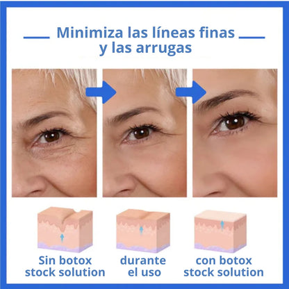 Botox Stock Solution - Rejuvenece tu Belleza Natural