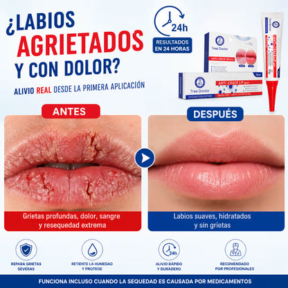 Reparación de labios secos y agrietados