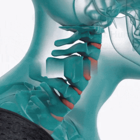 PosturePro - Corrector de Postura Soporte Lumbar - Ajustable y Còmodo