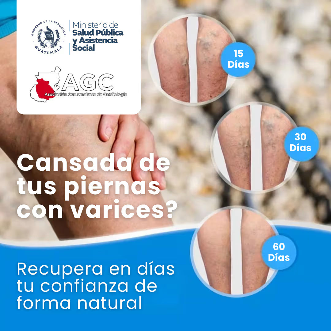 Veins - Tratamiento Venas Varicosas - 100% NATURAL - 2X1