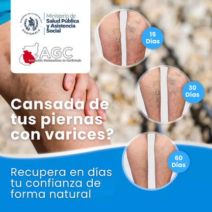 Veins - Tratamiento Venas Varicosas - 100% NATURAL - 2X1