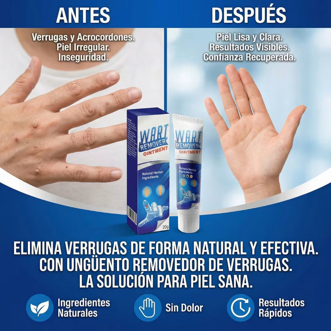 Tratamiento Eliminador de Verrugas- Paga 1 Lleva 2 + Envio Gratis