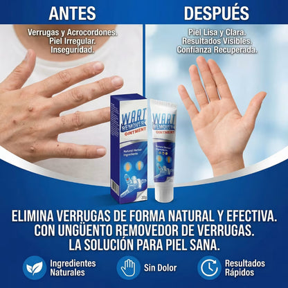 Tratamiento Eliminador de Verrugas- Paga 1 Lleva 2 + Envio Gratis
