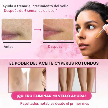 Aceite de Cyperus para Depilación Natural